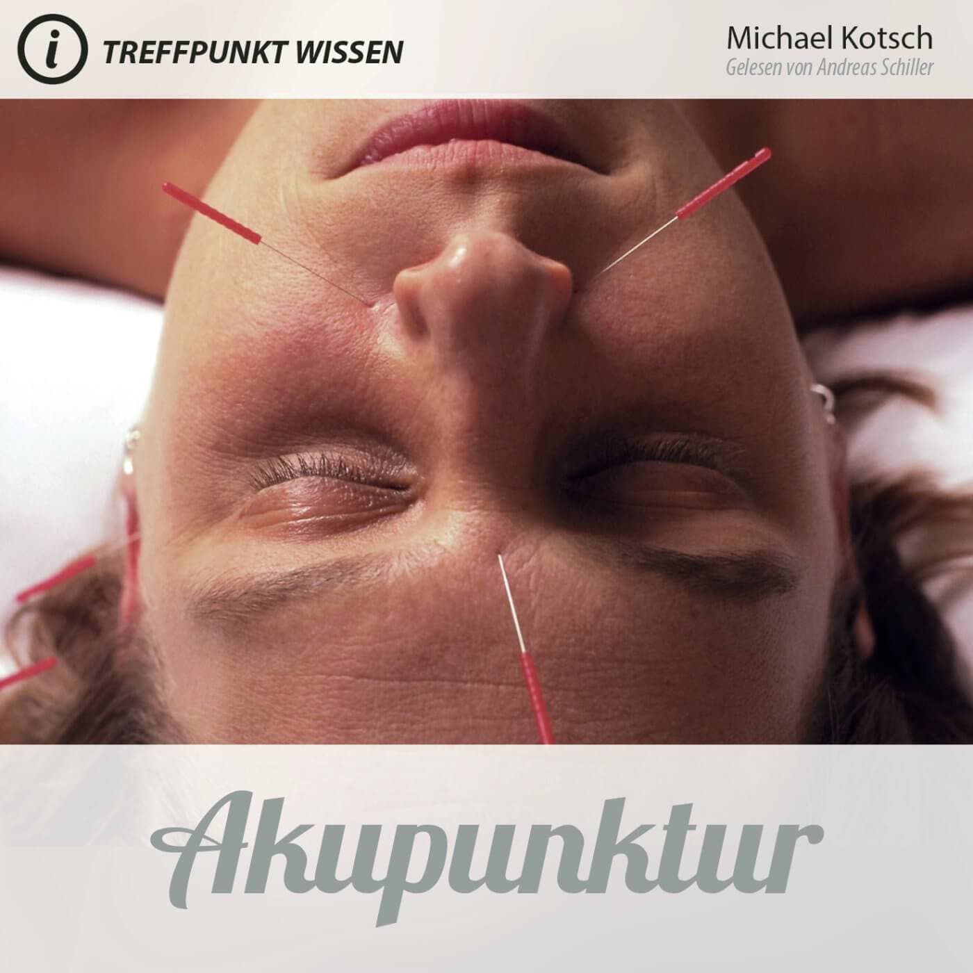 Cover: Akupunktur - Treffpunkt Wissen